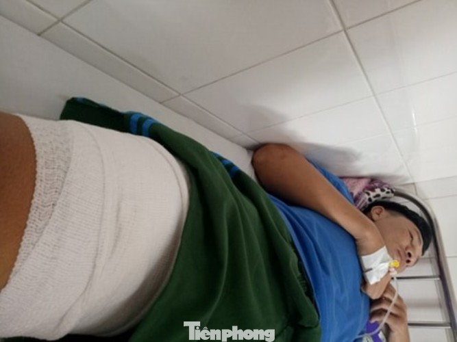 Phút sinh tử dân phòng đối mặt, dính ‘mưa đạn’ từ tên cướp xe ảnh 2