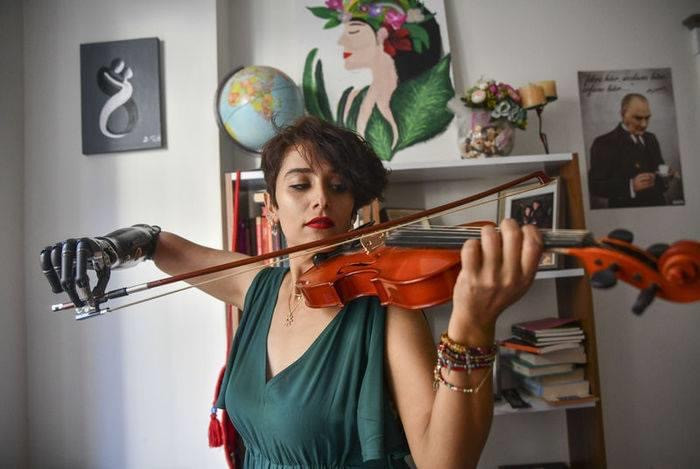 4 lần thoát chết, cô gái trẻ vẫn vững tin vào cuộc sống với cánh tay giả là bạn đồng hành ảnh 6