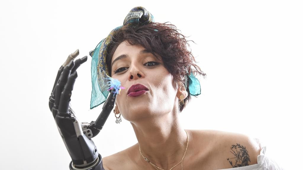 4 lần thoát chết, cô gái trẻ vẫn vững tin vào cuộc sống với cánh tay giả là bạn đồng hành ảnh 2