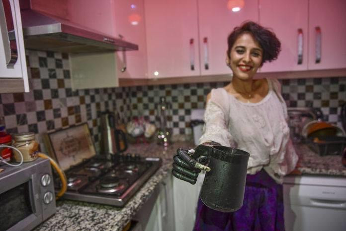 4 lần thoát chết, cô gái trẻ vẫn vững tin vào cuộc sống với cánh tay giả là bạn đồng hành ảnh 3