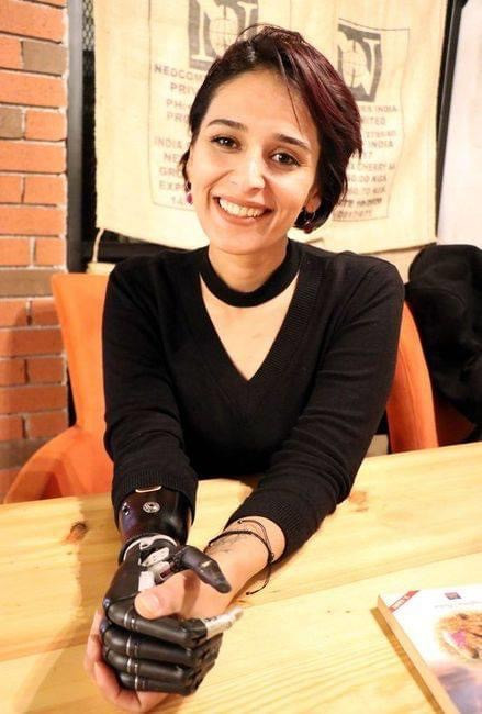 4 lần thoát chết, cô gái trẻ vẫn vững tin vào cuộc sống với cánh tay giả là bạn đồng hành ảnh 7