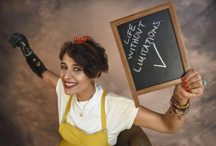 4 lần thoát chết, cô gái trẻ vẫn vững tin vào cuộc sống với cánh tay giả là bạn đồng hành ảnh 1