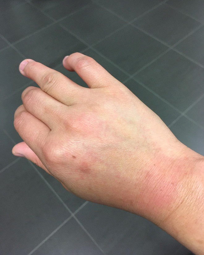 ‘Cô gái H’Mông’ kể chuyện làm việc ở bệnh viện Bỉ giữa đợt dịch ảnh 2