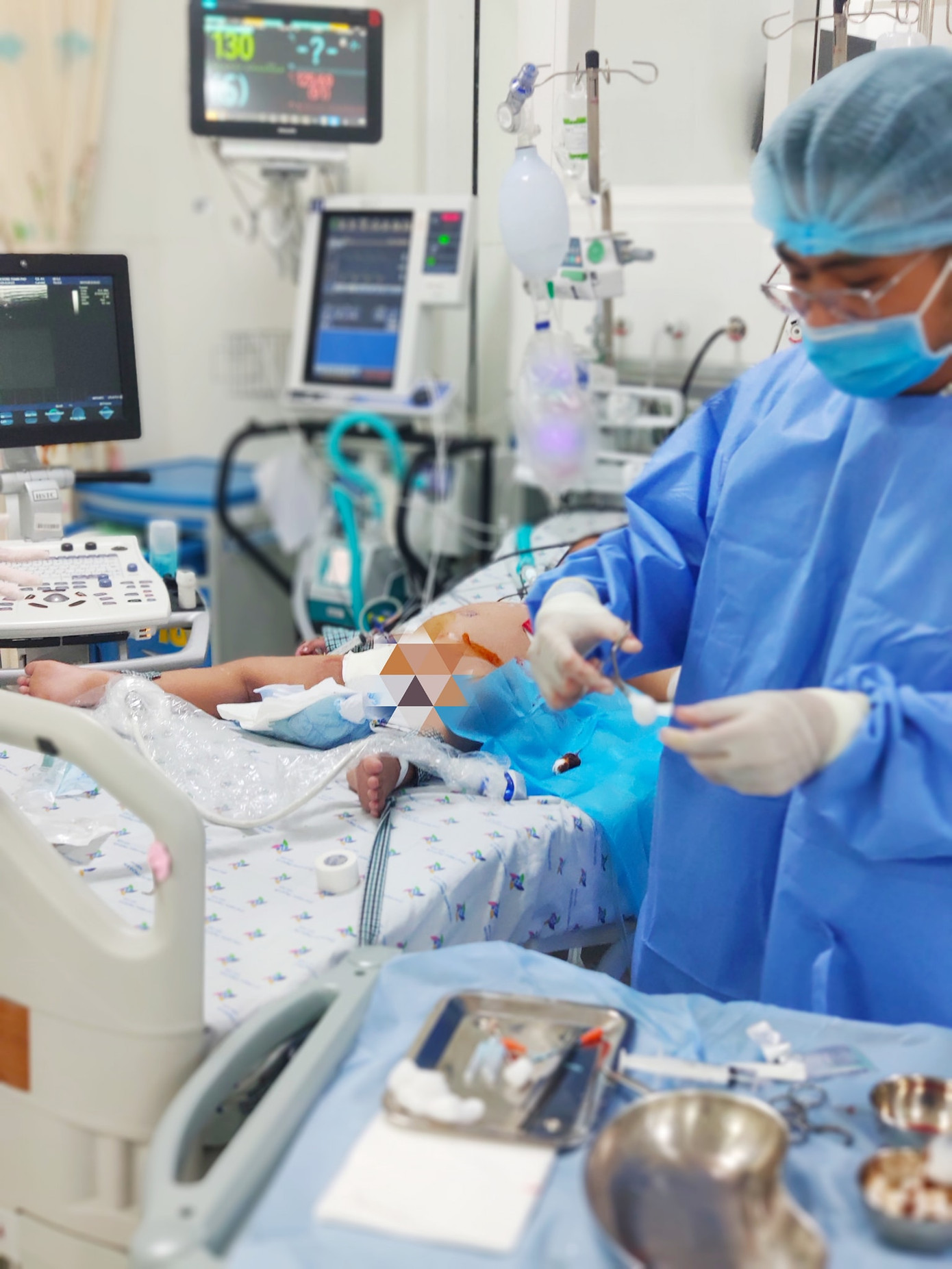 Sốc sốt xuất huyết Dengue nguy kịch, bé gái 5 tuổi được cứu sống thần kỳ ảnh 1