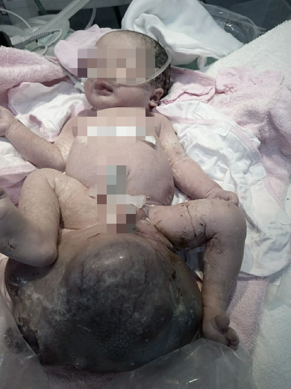 Mẹ trẻ kiên cường sinh con cùng khối u “khủng” ảnh 1