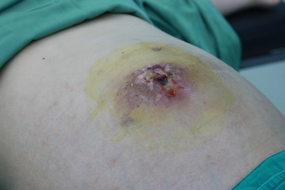 Mất cơ hội làm mẹ vì nhờ 'lang băm’ chữa bệnh ảnh 1