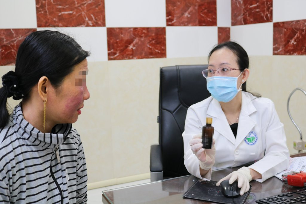 Nữ bệnh nhân cầu cứu bác sỹ khi sử dụng mỹ phẩm trôi nổi làm trắng da cấp tốc (ảnh: BVCC) Sưng phù mặt, mụn kết tảng do làm trắng da cấp tốc ảnh 1