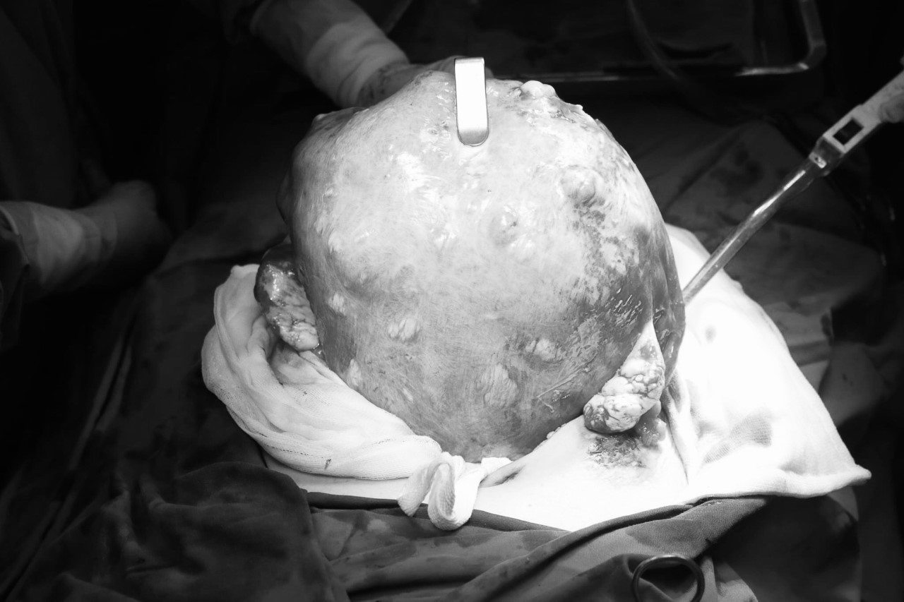 Mất cơ hội làm mẹ vì nhờ 'lang băm’ chữa bệnh ảnh 2