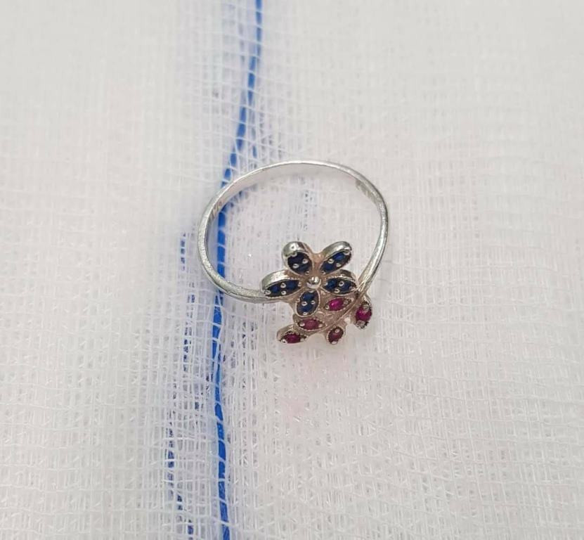 Được tặng nhẫn, bé gái nuốt trôi xuống họng ảnh 2