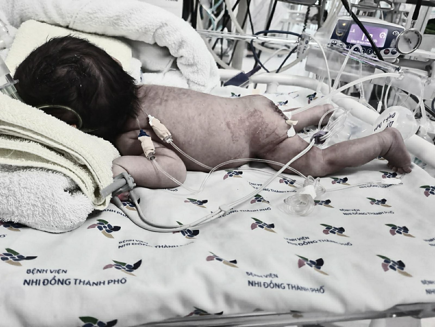 Mẹ trẻ kiên cường sinh con cùng khối u “khủng” ảnh 2