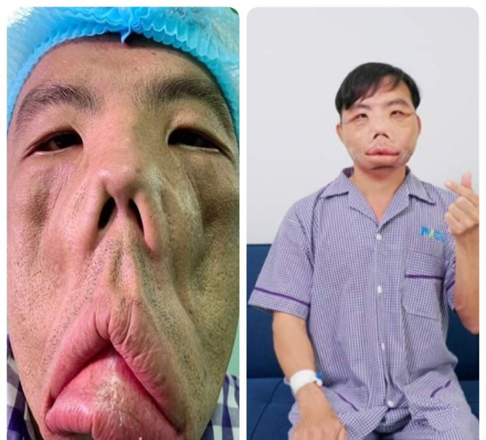  Ngắm gương mặt mới của chàng trai 'mặt quỷ' ảnh 1