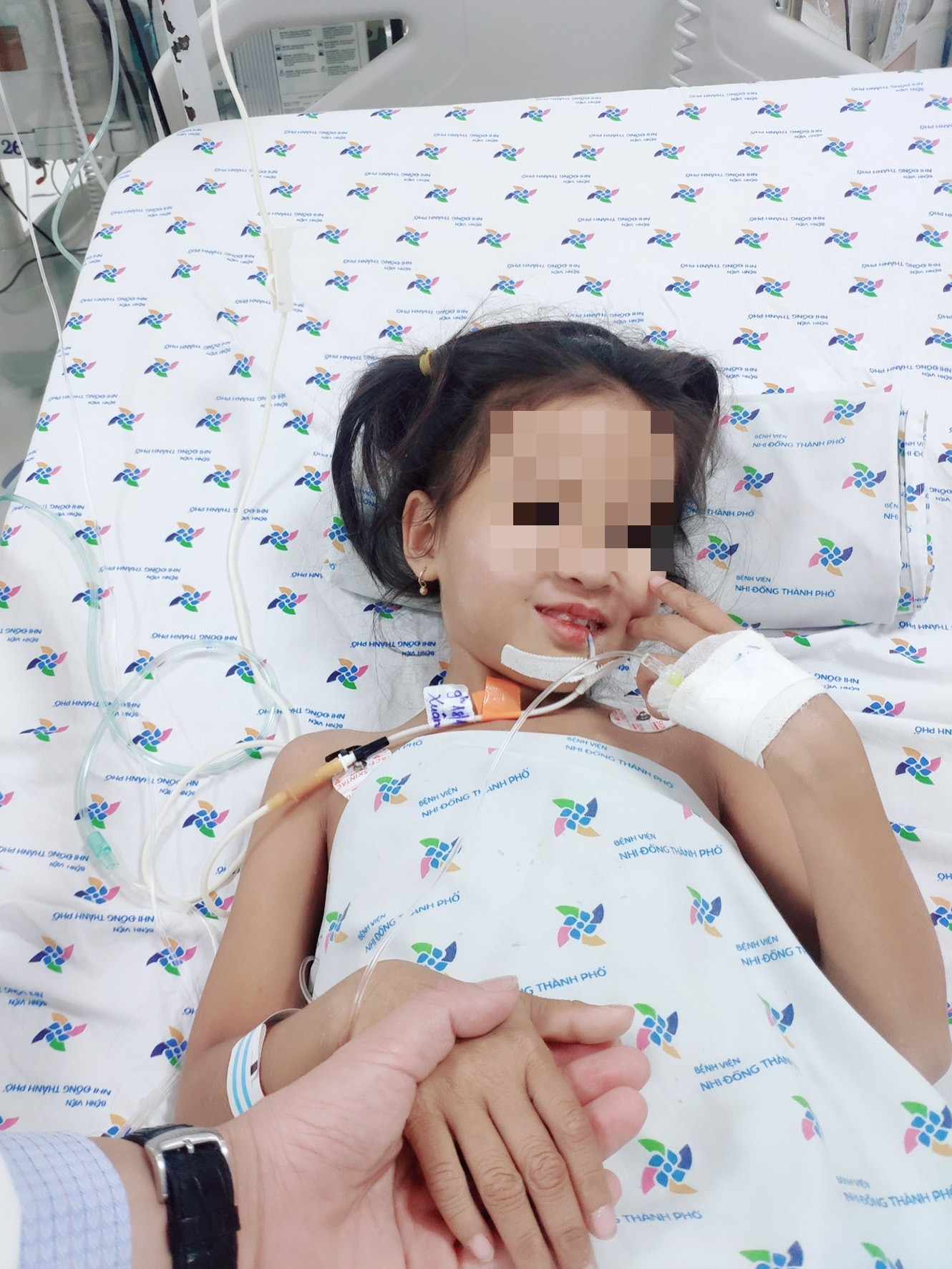 Điều trị thành công bé gái bị bệnh hiếm gặp biến gương mặt thành cứng đơ như tượng ảnh 1