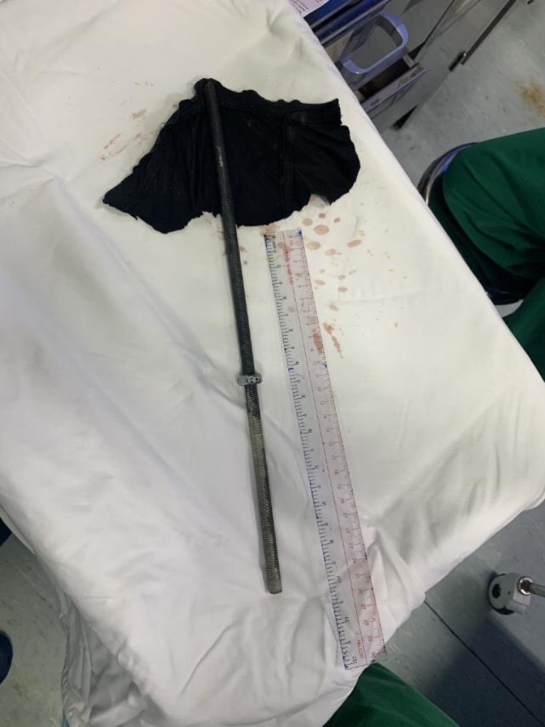 Nam thanh niên bị thanh sắt đâm xuyên cổ khi đang sửa máy lạnh ảnh 1