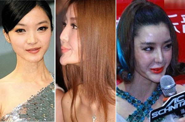 Những ‘thảm họa dao kéo’ của showbiz châu Á ảnh 5