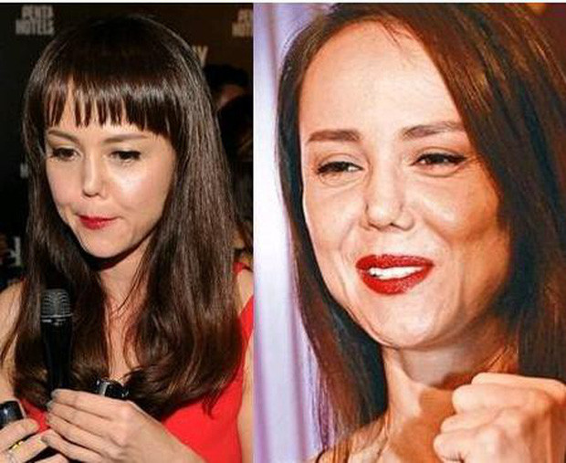 Những ‘thảm họa dao kéo’ của showbiz châu Á ảnh 12