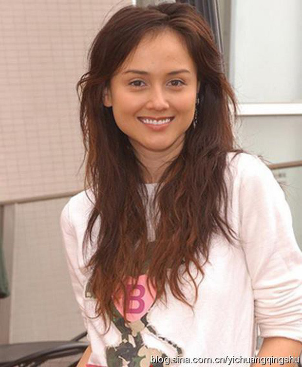 Những ‘thảm họa dao kéo’ của showbiz châu Á ảnh 11