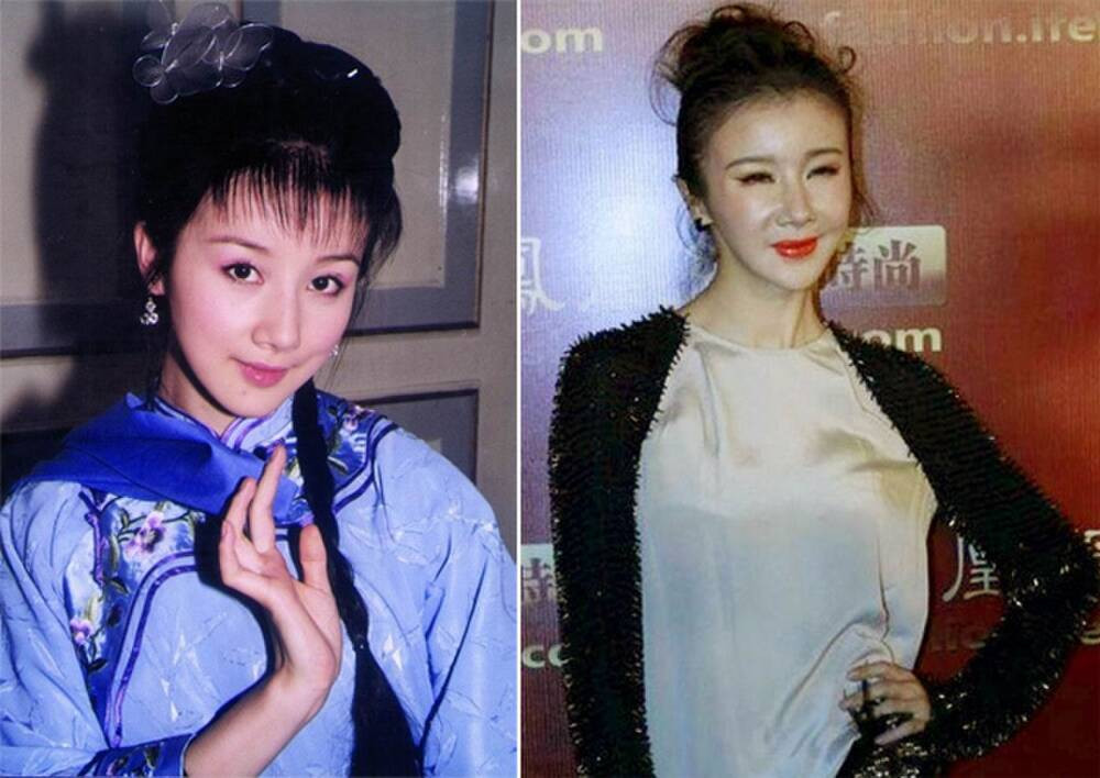 Những ‘thảm họa dao kéo’ của showbiz châu Á ảnh 10