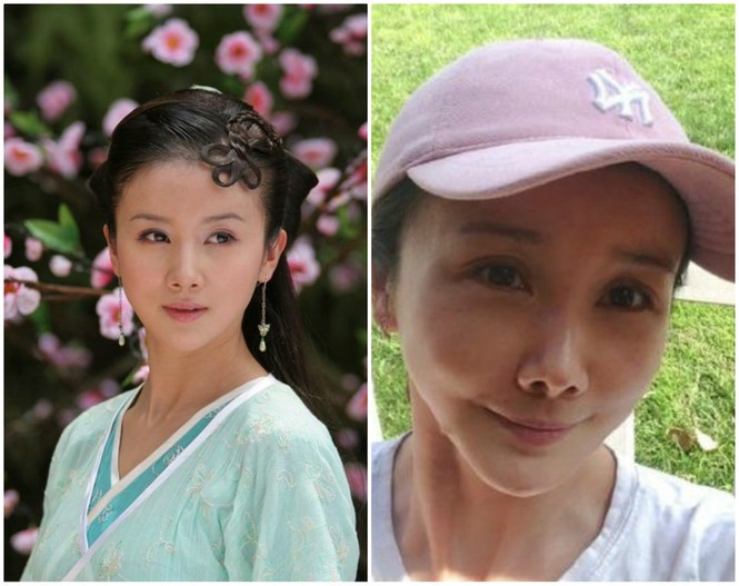 Những ‘thảm họa dao kéo’ của showbiz châu Á ảnh 9