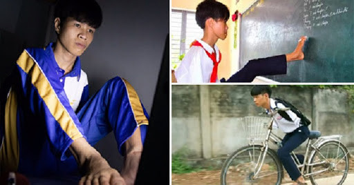 Cậu bé ‘chim cánh cụt’ 3 tuổi biết ăn bằng chân đã là sinh viên, được Google mời làm việc ảnh 3