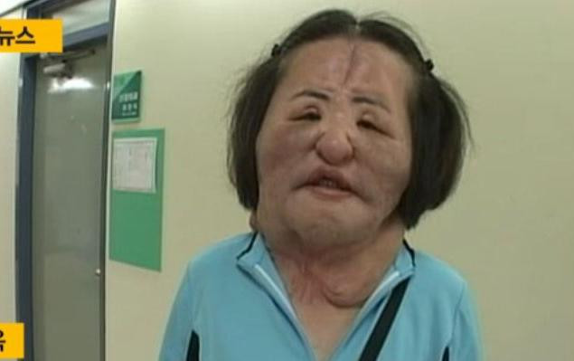 Những ‘thảm họa dao kéo’ của showbiz châu Á ảnh 3