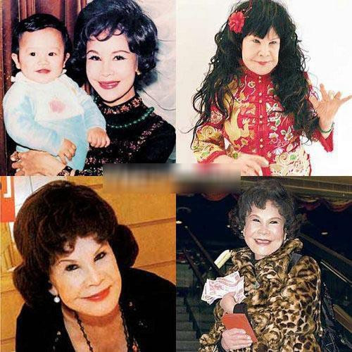 Những ‘thảm họa dao kéo’ của showbiz châu Á ảnh 6