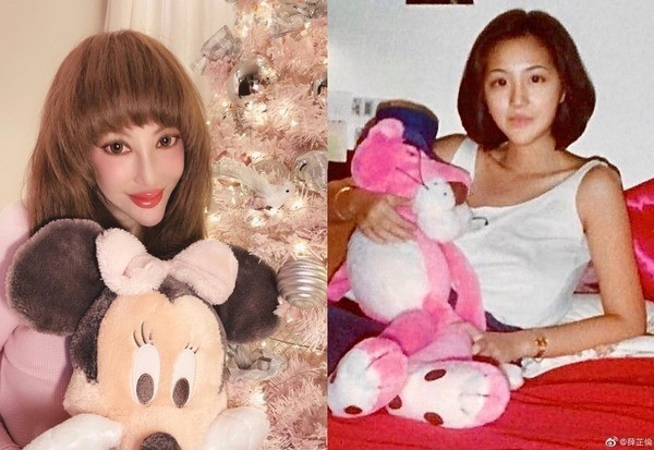 Những ‘thảm họa dao kéo’ của showbiz châu Á ảnh 8