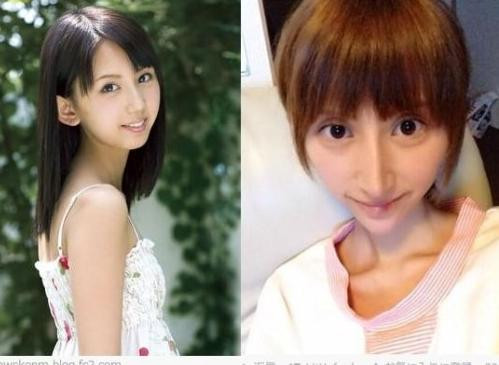 Những ‘thảm họa dao kéo’ của showbiz châu Á ảnh 4