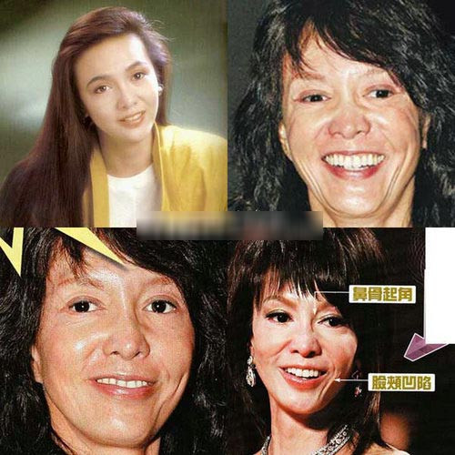 Những ‘thảm họa dao kéo’ của showbiz châu Á ảnh 7