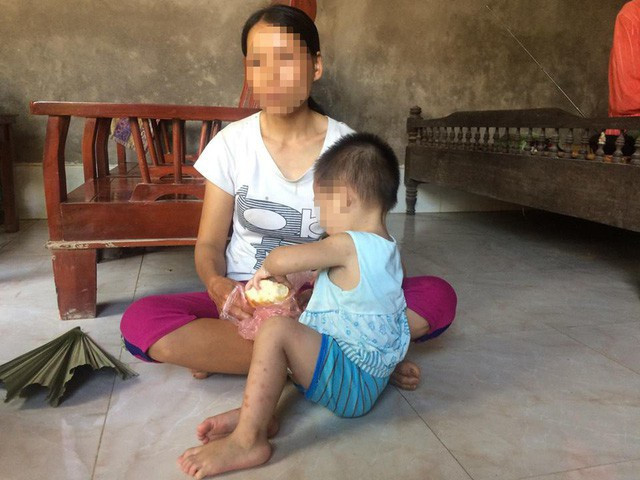 Số trẻ em nhiễm HIV độ tuổi 15-16 ngày càng gia tăng ảnh 1