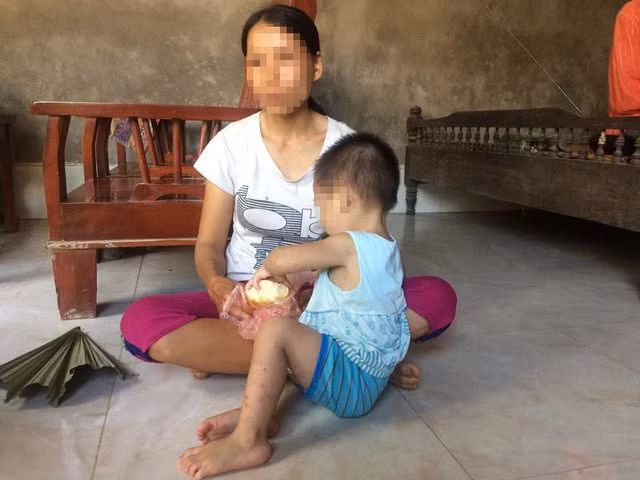 Số trẻ em nhiễm HIV độ tuổi 15-16 ngày càng gia tăng ảnh 1