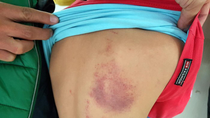 Những vụ giáo viên đánh tới tấp học sinh gây chấn động năm 2019 ảnh 3