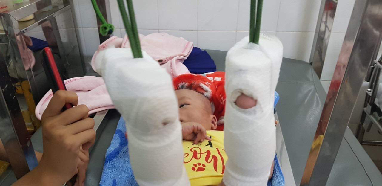 Bé trai 4 tháng tuổi nghi bị cha đánh xuất huyết não ảnh 1