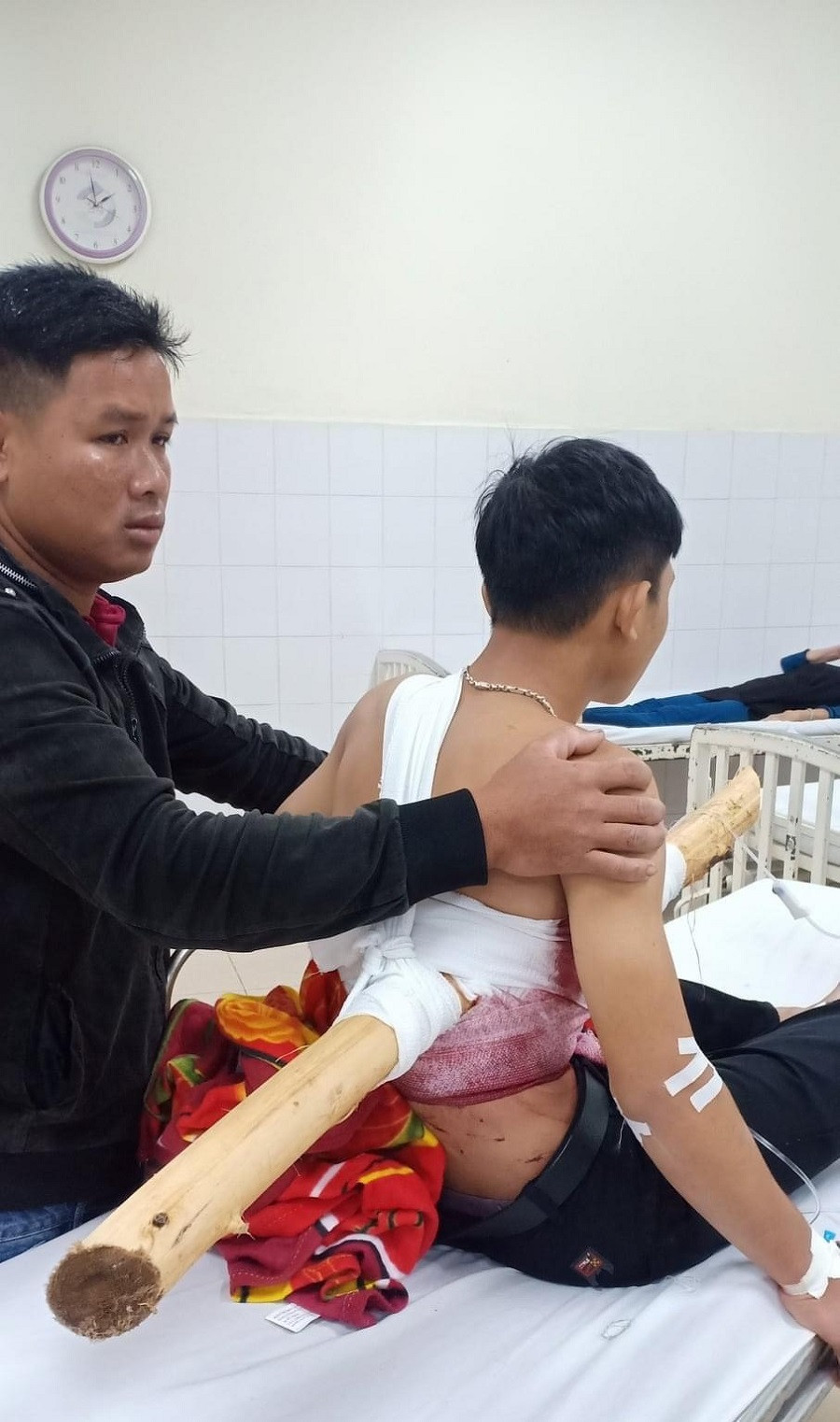 Quảng Ngãi: Nam thanh niên bị thanh gỗ to đâm xuyên người ảnh 2