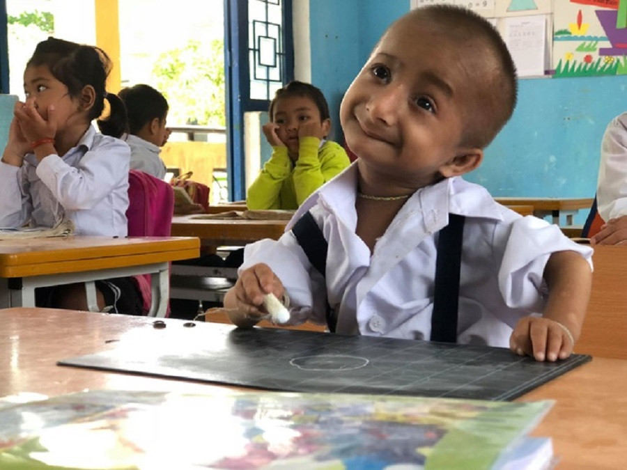 Cậu bé tí hon nhất Việt Nam vừa qua đời sau nhiều ngày nằm viện ảnh 2