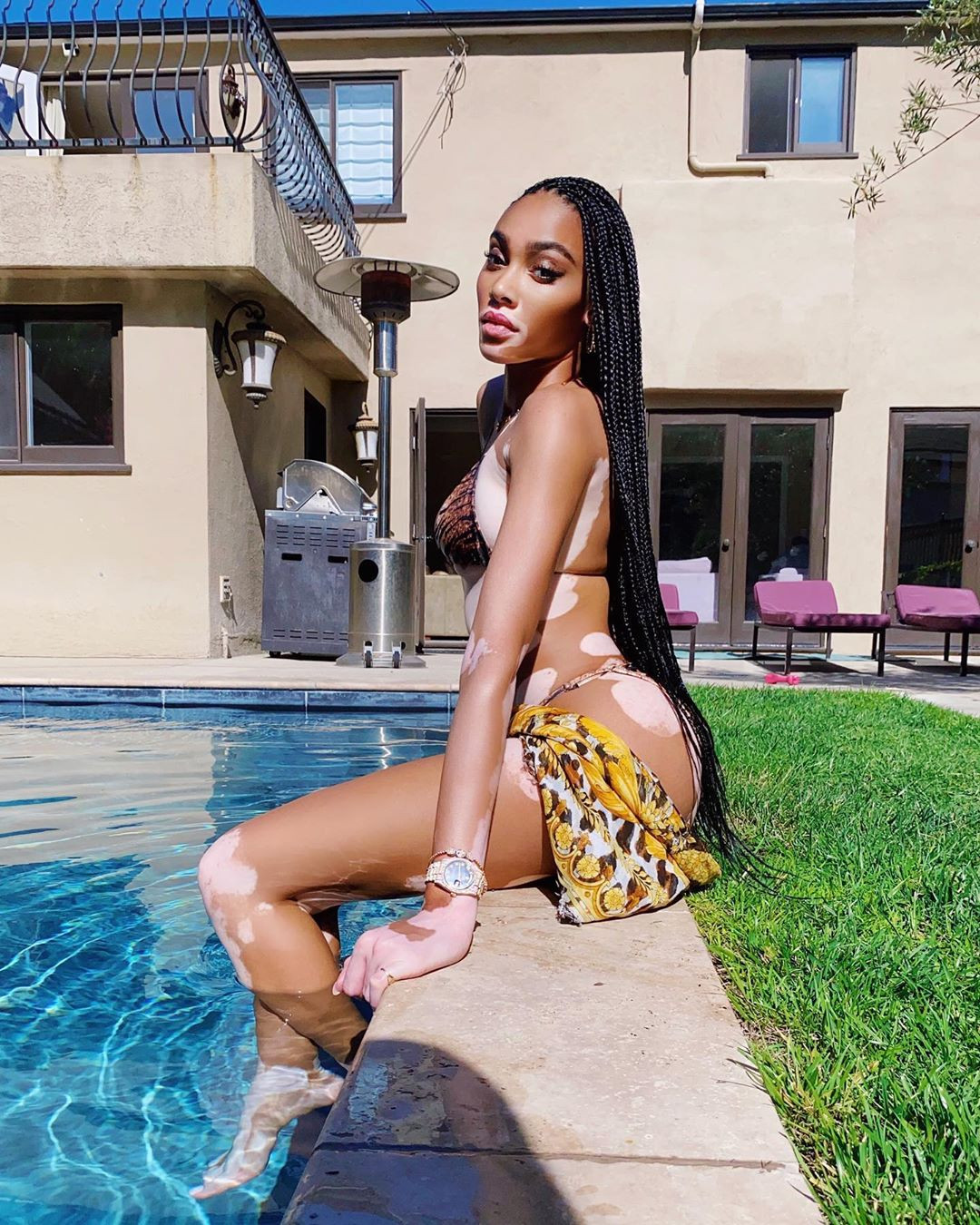 Winnie Harlow diện bikini thả dáng quyến rũ bên bể bơi ảnh 4