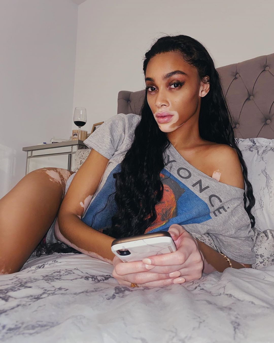 Winnie Harlow diện bikini thả dáng quyến rũ bên bể bơi ảnh 5