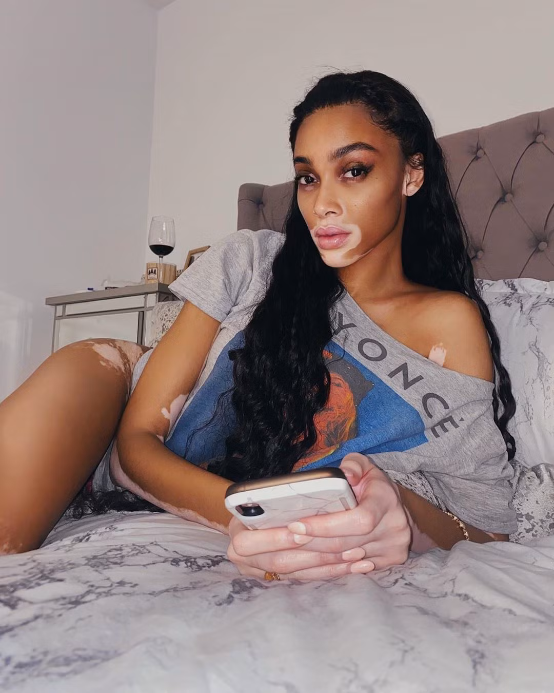 Winnie Harlow diện bikini thả dáng quyến rũ bên bể bơi ảnh 5