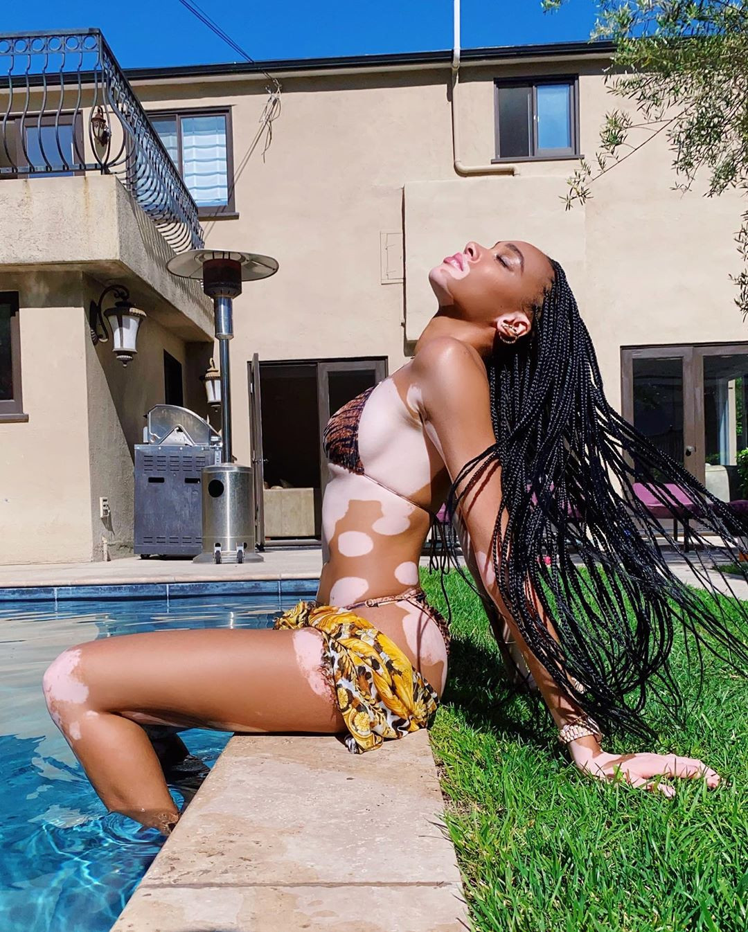 Winnie Harlow diện bikini thả dáng quyến rũ bên bể bơi ảnh 2