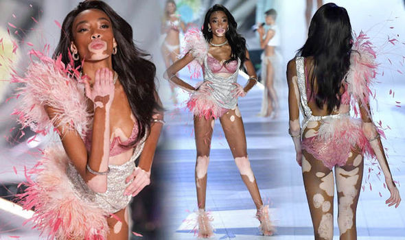 Winnie Harlow diện bikini thả dáng quyến rũ bên bể bơi ảnh 6
