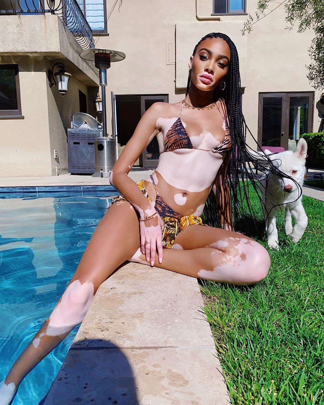 Winnie Harlow diện bikini thả dáng quyến rũ bên bể bơi ảnh 1