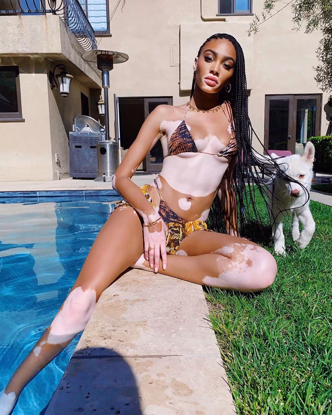 Winnie Harlow diện bikini thả dáng quyến rũ bên bể bơi ảnh 1
