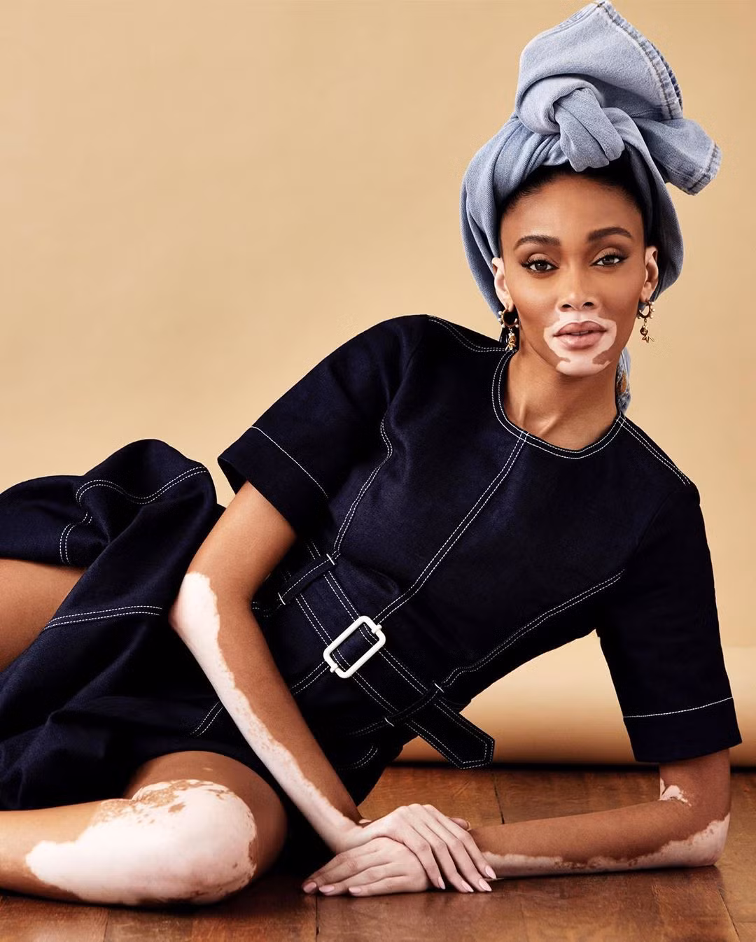 Siêu mẫu Winnie Harlow diện bikini thả dáng gợi cảm trên mái nhà ảnh 10