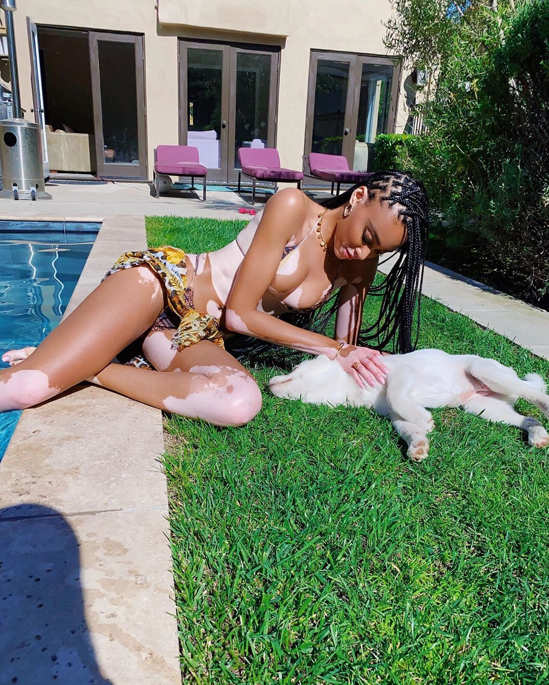 Winnie Harlow diện bikini thả dáng quyến rũ bên bể bơi ảnh 3