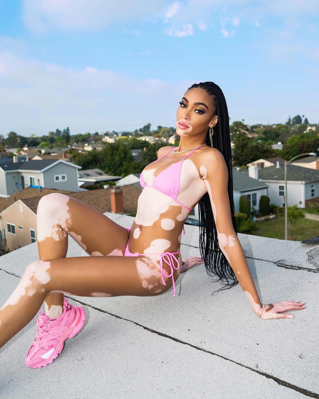 Siêu mẫu Winnie Harlow diện bikini thả dáng gợi cảm trên mái nhà ảnh 1