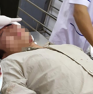 Điều tra nhóm người xông vào trạm kiểm lâm hành hung nhân viên, cướp đi xe máy ảnh 1