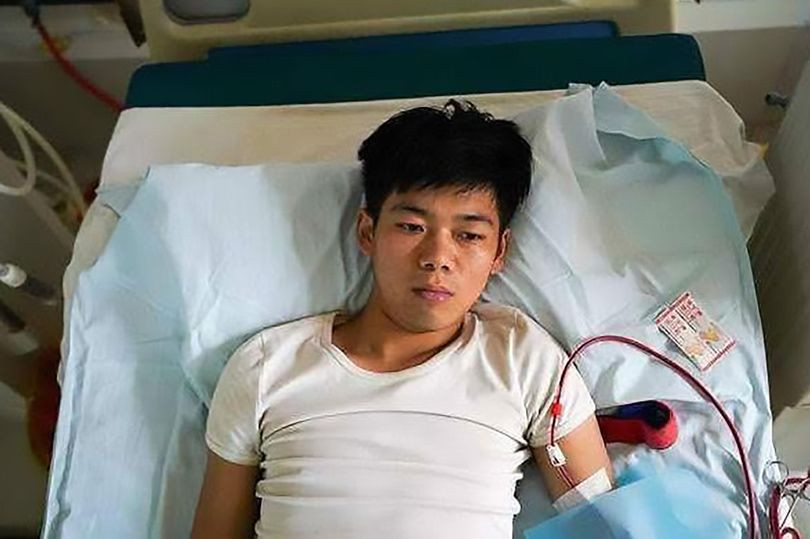 Wang đã bán một bên thận của mình vào năm 2011. Ảnh: AsiaWire Bán thận để mua iPhone và iPad, một chàng trai đã phải nằm liệt giường suốt đời ảnh 1