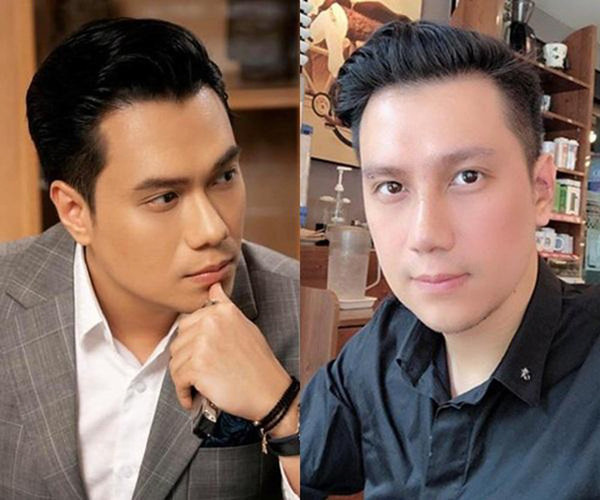 Diễn viên Việt Anh lại lộ nhan sắc khác lạ hậu phẫu thuật thẩm mỹ ảnh 7