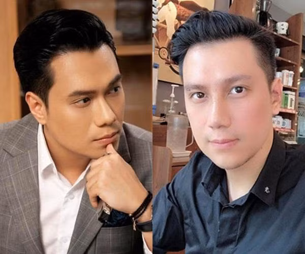 Diễn viên Việt Anh lại lộ nhan sắc khác lạ hậu phẫu thuật thẩm mỹ ảnh 7