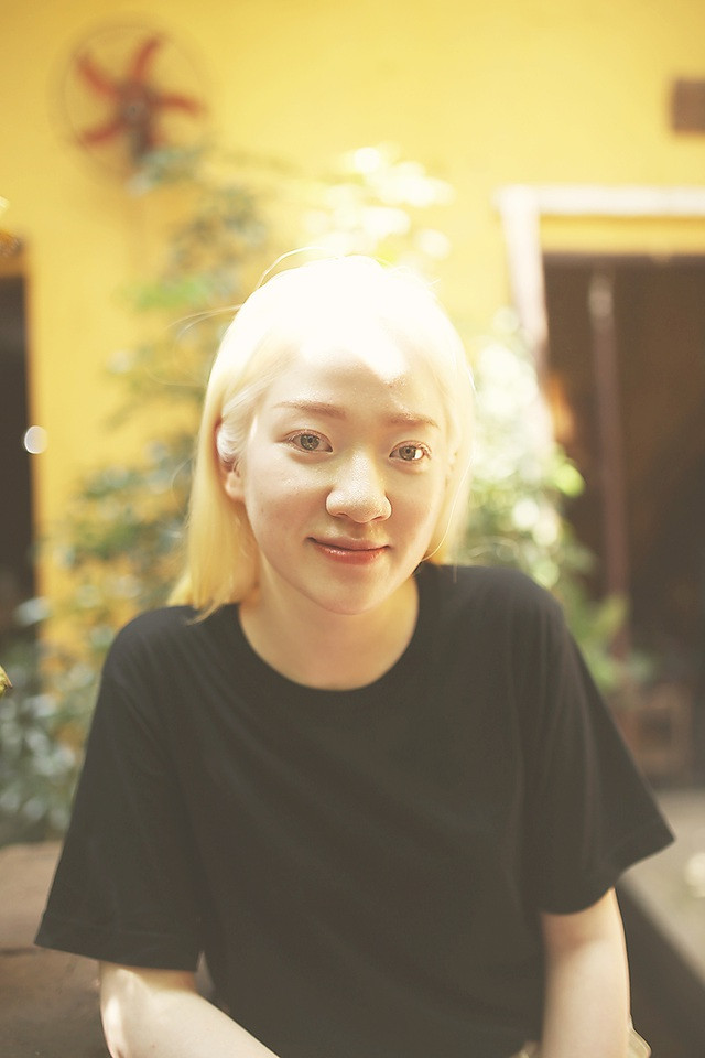 Nữ sinh bạch tạng sở hữu vẻ đẹp như nàng công chúa tuyết ảnh 6