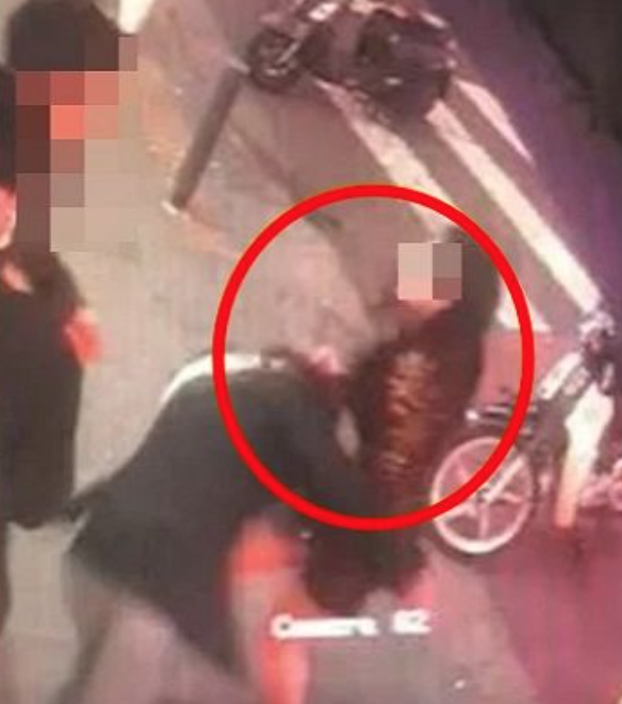 Người mẫu khiếm thính Hàn bị đánh đến chấn động não vì vô tình va phải người phụ nữ ảnh 2